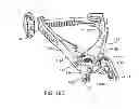 Fig. 33 - Implantation tools for interspinous process spacing device