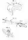 Fig. 02 - Apparatus and method for heart valve repair