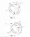 Fig. 03 - Transapical mitral valve repair device