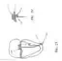 Fig. 20 - Transapical mitral valve repair device