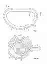 Fig. 02 - Prosthetic anatomical device with sewing cuff flange and anti-rotation feature