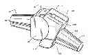 Fig. 01 - Metacarpal-phalangeal prosthesis