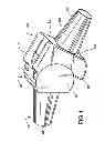 Fig. 02 - Metacarpal-phalangeal prosthesis