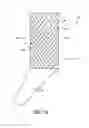 Fig. 06 - Anti-reflux prosthesis