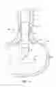Fig. 07 - Anti-reflux prosthesis