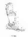 Fig. 08 - Controlling power in a prosthesis or orthosis based on predicted walking speed or surrogate for same
