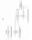 Fig. 05 - METHOD FOR DISPLAYING AN OVERLAID WEB SURVEY ICON