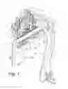 Fig. 02 - Patient positioning device for stereotactic radiosurgery