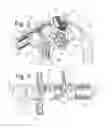 Fig. 03 - Patient positioning device for stereotactic radiosurgery