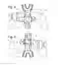 Fig. 04 - Patient positioning device for stereotactic radiosurgery