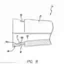 Fig. 06 - Electric toothbrush attachment mechanism