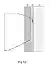 Fig. 06 - Shaped fastening systems for use with absorbent articles