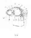 Fig. 06 - SECURING DEVICE FOR SEUCRING BICYCLE FRAME TO BICYCLE CARRY RACK