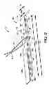 Fig. 04 - Method of manufacturing tampons