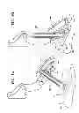 Fig. 04 - Pedal measurement gauge