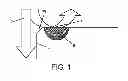 Fig. 02 - THICK THERMAL BARRIER COATING FOR SUPERABRASIVE TOOL AND METHOD OF MAKING THE SAME