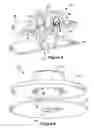 Fig. 06 - Fuel injection assemblies in combustion turbine engines