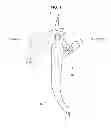 Fig. 02 - Pedal assembly for protecting driver