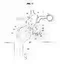 Fig. 07 - Pedal assembly for protecting driver