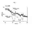 Fig. 03 - DEVICE AND METHOD FOR DETERMINING AND CONTROLLING COMBUSTION MISFIRE OF VEHICLE ENGINE
