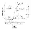 Fig. 02 - METHOD AND APPARATUS FOR ASSISTING AIRWAY CLEARANCE
