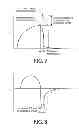 Fig. 08 - METHOD AND APPARATUS FOR ASSISTING AIRWAY CLEARANCE