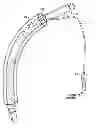 Fig. 01 - Expandable Inter Vivos Tube