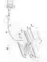 Fig. 08 - Expandable Inter Vivos Tube