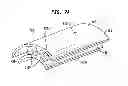 Fig. 09 - Expandable Inter Vivos Tube
