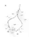 Fig. 01 - Quiet nasal cannula