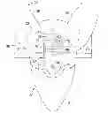 Fig. 01 - Laboring patient dignity poo pouch