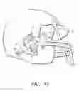 Fig. 08 - Mouth guard retainer