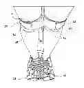 Fig. 01 - MOTION RESTRICTION KIT
