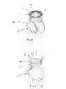 Fig. 02 - Adhesive holding system