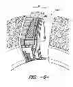 Fig. 06 - Tacky Finish and Textile Materials and Articles Treated Therewith