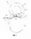 Fig. 07 - INCREMENTALLY FORMING THREE-DIMENSIONAL STRUCTURE FROM RECEIVER