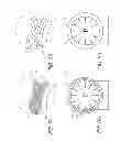 Fig. 07 - Methods for manufacturing multi-layer balloons for medical applications