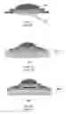Fig. 03 - Method of Forming Thermal Conductive Pillar in Metal Core Printed Circuit Board