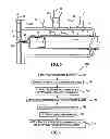 Fig. 04 - Pressure debulking system