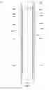 Fig. 05 - Closure assemblies for movable partitions, movable partition systems including closure assemblies and related methods