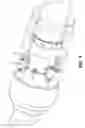 Fig. 03 - One trip packer plug debris milling and removal method