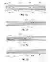 Fig. 07 - Method and apparatus for wellbore fluid treatment