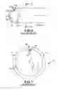 Fig. 04 - Toneable conduit optimized for conduit shrinkage and elongation