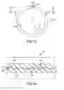 Fig. 08 - Toneable conduit optimized for conduit shrinkage and elongation