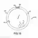 Fig. 09 - Toneable conduit optimized for conduit shrinkage and elongation
