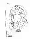 Fig. 09 - CONTROL SYSTEMS FOR FRICTION CLUTCH ASSEMBLIES