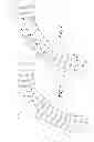 Fig. 07 - Conveyor system wear indication devices and methods
