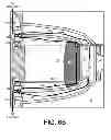 Fig. 06 - Stationary boom support system