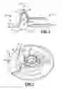 Fig. 03 - Self-adjusting connector