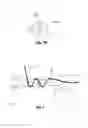 Fig. 04 - Presser finger for a roving winder, roving winder, and method of winding a roving